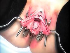 Hooks in labia